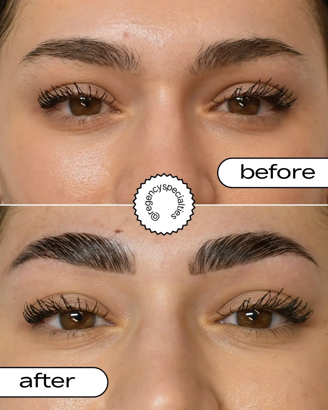 Before and after comparison of eyebrow shaping treatment at Regency Specialties